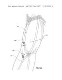 VASCULAR ACCESS PORT SYSTEMS AND METHODS diagram and image