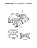 VASCULAR ACCESS PORT SYSTEMS AND METHODS diagram and image