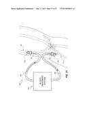 VASCULAR ACCESS PORT SYSTEMS AND METHODS diagram and image