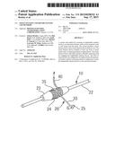 TISSUE FIXATION AND REPAIR SYSTEMS AND METHODS diagram and image