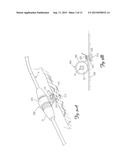 TISSUE FIXATION AND REPAIR SYSTEMS AND METHODS diagram and image