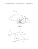 TISSUE FIXATION AND REPAIR SYSTEMS AND METHODS diagram and image