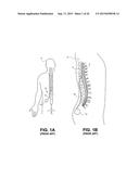 SELECTIVE STIMULATION SYSTEMS AND SIGNAL PARAMETERS FOR MEDICAL CONDITIONS diagram and image