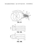 SELECTIVE STIMULATION SYSTEMS AND SIGNAL PARAMETERS FOR MEDICAL CONDITIONS diagram and image