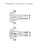 SELECTIVE STIMULATION SYSTEMS AND SIGNAL PARAMETERS FOR MEDICAL CONDITIONS diagram and image