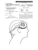 Method for the Treatment of Ischemic Stroke by Applying an Electromagnetic     Field diagram and image