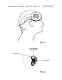 Method for the Treatment of Ischemic Stroke by Applying an Electromagnetic     Field diagram and image