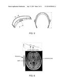 Method for the Treatment of Ischemic Stroke by Applying an Electromagnetic     Field diagram and image