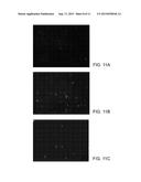 Method for the Treatment of Ischemic Stroke by Applying an Electromagnetic     Field diagram and image