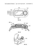 Interactive Athletic Equipment System diagram and image