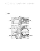 Method for Diagnosing a Molecular Phenotype of a Patient Suffering From an     Illness Accompanied by Chronic Inflammation diagram and image