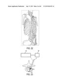 Systems And Methods For Surgical And Interventional Planning, Support,     Post-Operative Follow-Up, And Functional Recovery Tracking diagram and image