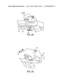 Systems And Methods For Surgical And Interventional Planning, Support,     Post-Operative Follow-Up, And Functional Recovery Tracking diagram and image