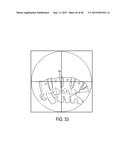 Systems And Methods For Surgical And Interventional Planning, Support,     Post-Operative Follow-Up, And Functional Recovery Tracking diagram and image