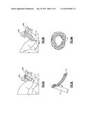 HAND HELD LINK MAKING DEVICE AND KIT diagram and image