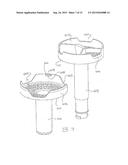 Potato Ricer diagram and image