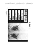 SCAN GEOMETRY CORRECTIONS FOR TOMOSYNTHESIS MOBILE RADIOGRAPHIC APPARATUS diagram and image