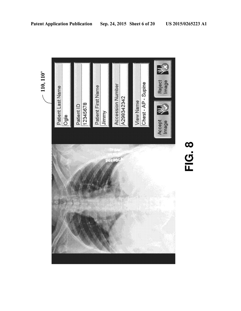 SCAN GEOMETRY CORRECTIONS FOR TOMOSYNTHESIS MOBILE RADIOGRAPHIC APPARATUS - diagram, schematic, and image 07