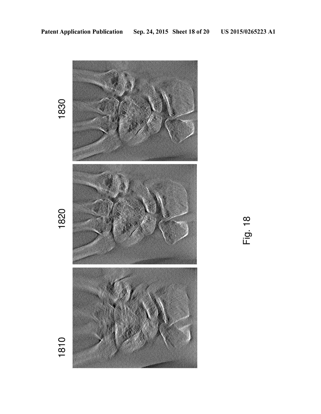 SCAN GEOMETRY CORRECTIONS FOR TOMOSYNTHESIS MOBILE RADIOGRAPHIC APPARATUS - diagram, schematic, and image 19