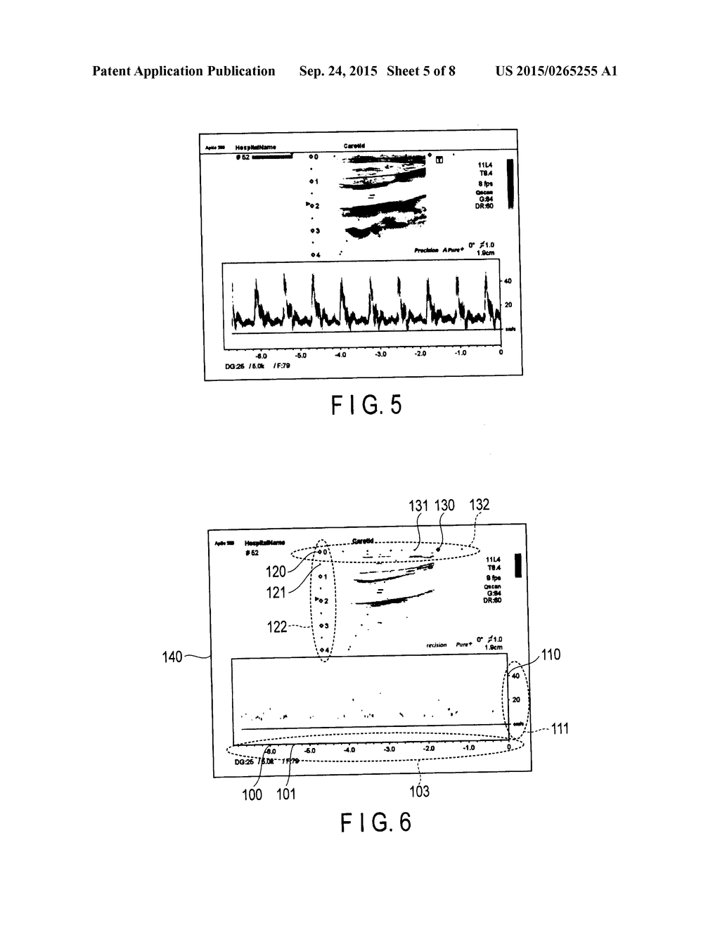 ULTRASONIC DIAGNOSIS APPARATUS, MEDICAL IMAGE PROCESSING APPARATUS AND     MEDICAL IMAGE PROCESSING METHOD - diagram, schematic, and image 06