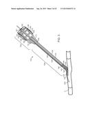 VESSEL ACCESS AND CLOSURE DEVICE diagram and image