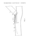 VESSEL ACCESS AND CLOSURE DEVICE diagram and image