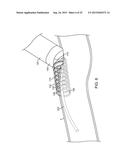 VESSEL ACCESS AND CLOSURE DEVICE diagram and image