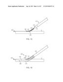 VESSEL ACCESS AND CLOSURE DEVICE diagram and image