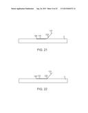 VESSEL ACCESS AND CLOSURE DEVICE diagram and image