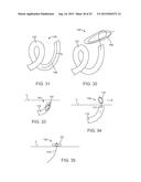 VESSEL ACCESS AND CLOSURE DEVICE diagram and image