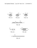 VESSEL ACCESS AND CLOSURE DEVICE diagram and image