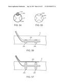 VESSEL ACCESS AND CLOSURE DEVICE diagram and image