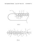 Surgical Method Utilizing a True Multiple-Fire Surgical Stapler diagram and image