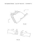 Surgical Method Utilizing a True Multiple-Fire Surgical Stapler diagram and image