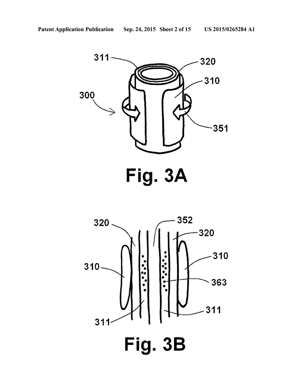 ENDOGRAFT DEVICES AND METHODS TO USE THE SAME - diagram, schematic, and image 03