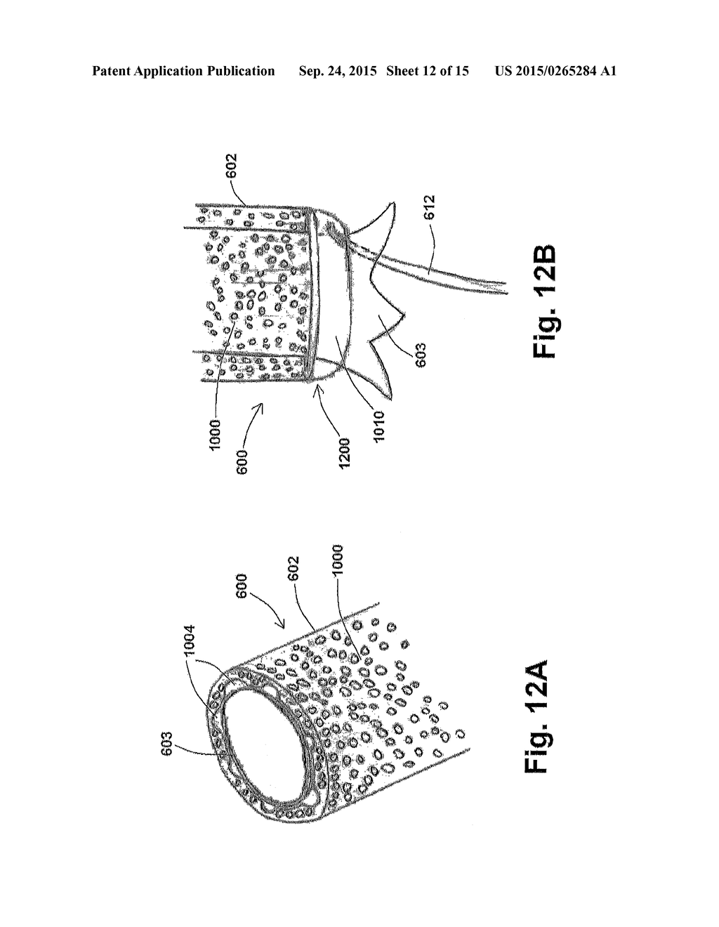 ENDOGRAFT DEVICES AND METHODS TO USE THE SAME - diagram, schematic, and image 13