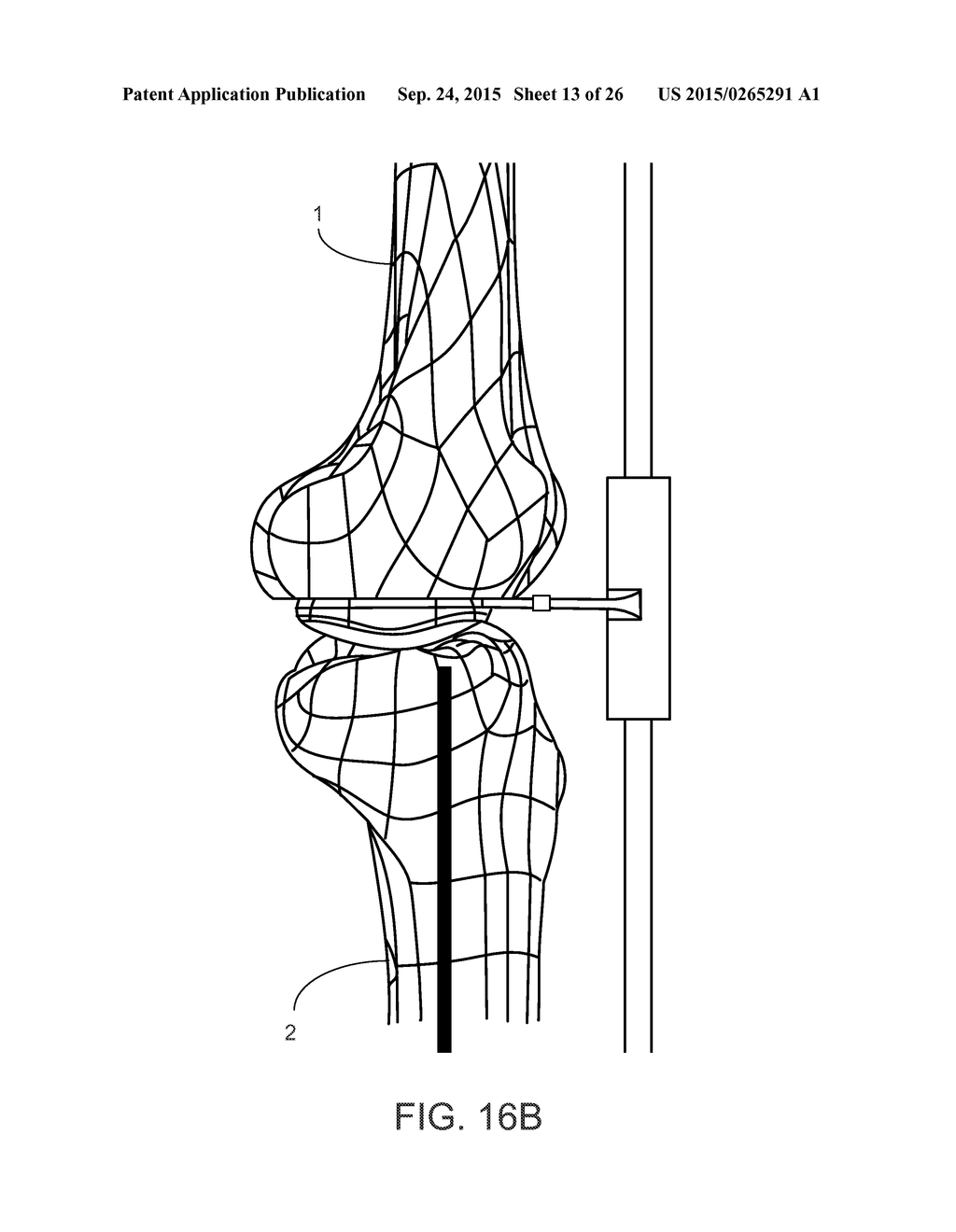 ALIGNMENT DEVICES AND METHODS - diagram, schematic, and image 14