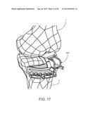 ALIGNMENT DEVICES AND METHODS diagram and image