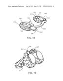 ALIGNMENT DEVICES AND METHODS diagram and image