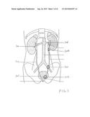 CALCULUS RETRIEVING/REMOVING DEVICE AND METHOD diagram and image