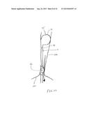 CALCULUS RETRIEVING/REMOVING DEVICE AND METHOD diagram and image