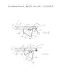 CALCULUS RETRIEVING/REMOVING DEVICE AND METHOD diagram and image