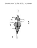 Minimally Invasive Thrombectomy diagram and image