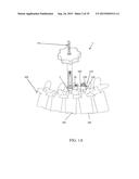 SPINAL ALIGNMENT CORRECTION SYSTEM AND METHODS OF USE diagram and image