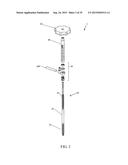 SPINAL ALIGNMENT CORRECTION SYSTEM AND METHODS OF USE diagram and image