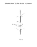 SPINAL ALIGNMENT CORRECTION SYSTEM AND METHODS OF USE diagram and image