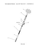 SPINAL ALIGNMENT CORRECTION SYSTEM AND METHODS OF USE diagram and image