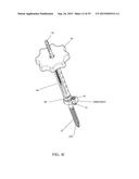 SPINAL ALIGNMENT CORRECTION SYSTEM AND METHODS OF USE diagram and image