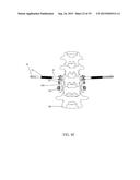 SPINAL ALIGNMENT CORRECTION SYSTEM AND METHODS OF USE diagram and image