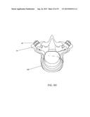 SPINAL ALIGNMENT CORRECTION SYSTEM AND METHODS OF USE diagram and image